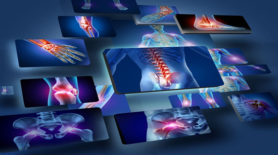 Osteoarticular