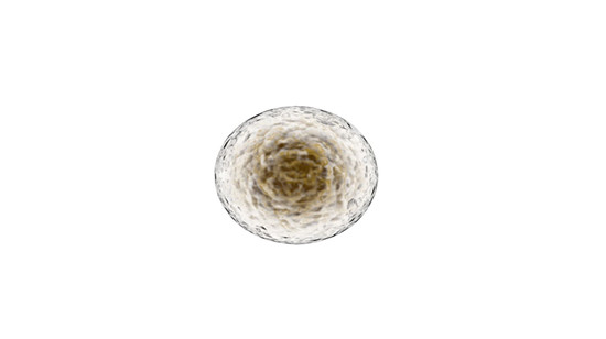 Autologous ADSC therapy for femoral head necrosis